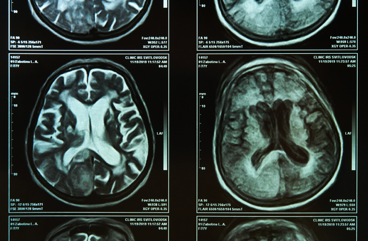 Head & Brain Injuries