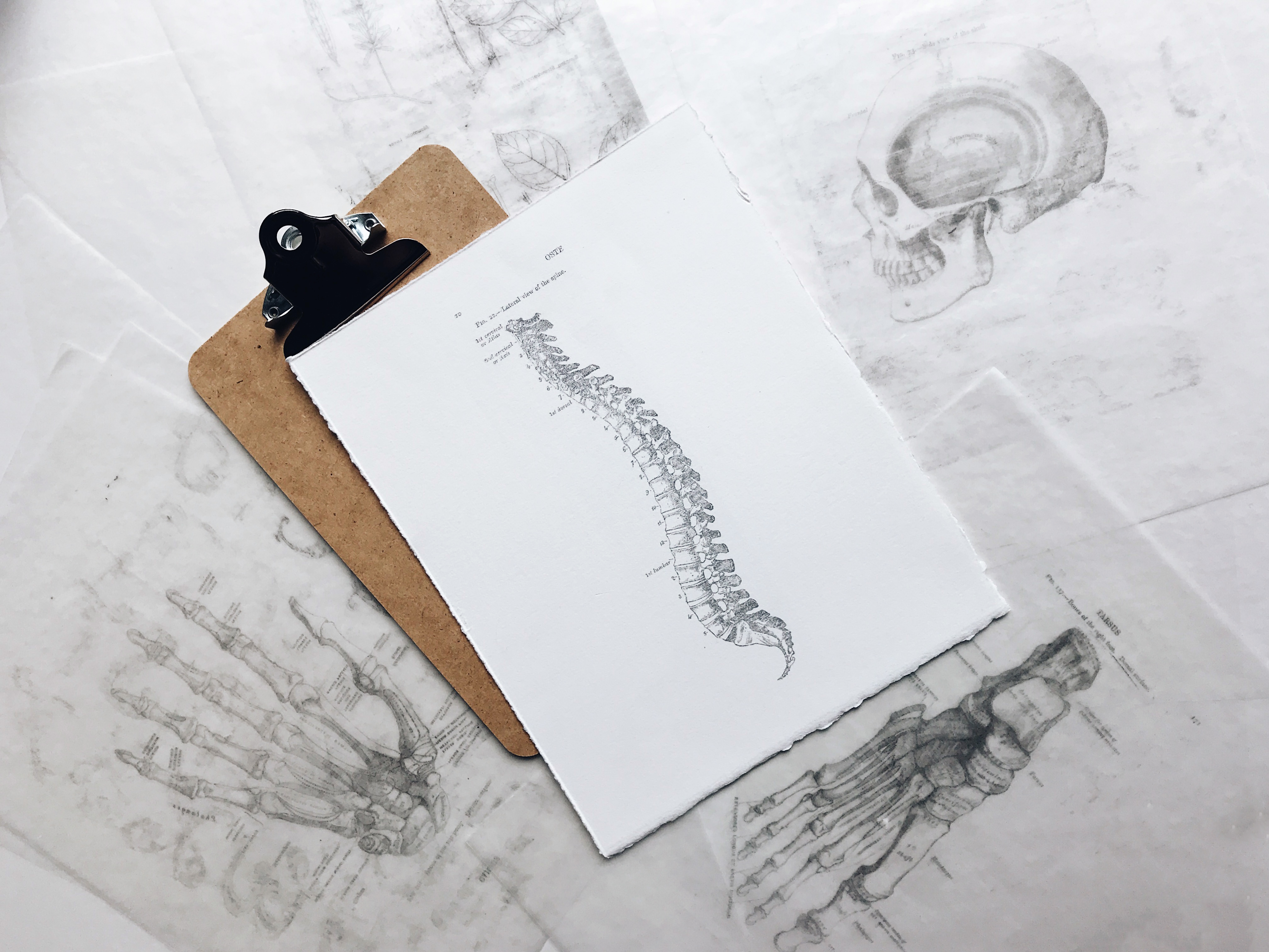 Herniated Disc Personal Injury Claims